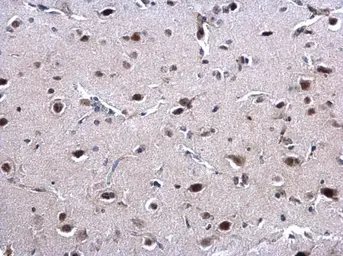 Anti-EWSR1 antibody used in IHC (Paraffin sections) (IHC-P). GTX114069