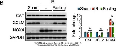 Anti-GCLM antibody used in Western Blot (WB). GTX114075