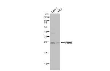 Anti-PNMT antibody [N2C3] used in Western Blot (WB). GTX114098