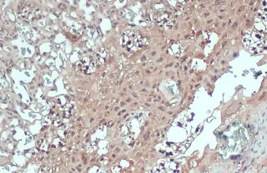 Anti-PNMT antibody [N2C3] used in IHC (Paraffin sections) (IHC-P). GTX114098