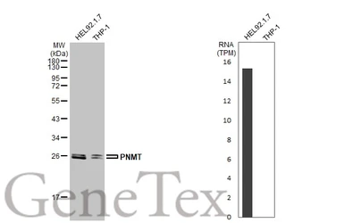 Anti-PNMT antibody [N2C3] used in Western Blot (WB). GTX114098