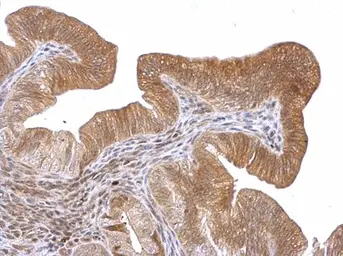 Anti-ROBO1 antibody used in IHC (Paraffin sections) (IHC-P). GTX114103