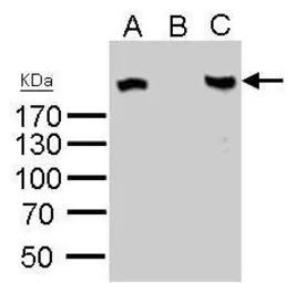 Anti-ROBO1 antibody used in Western Blot (WB). GTX114103