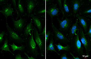 Anti-ROBO1 antibody used in Immunocytochemistry/ Immunofluorescence (ICC/IF). GTX114103