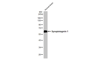 Anti-Synaptotagmin 1 antibody [N1C2] used in Western Blot (WB). GTX114124