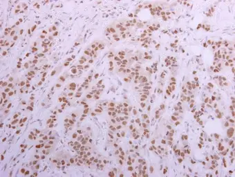 Anti-CUGBP1 antibody [N1C1-2] used in IHC (Paraffin sections) (IHC-P). GTX114129