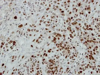 Anti-CUGBP1 antibody [N1C1-2] used in IHC (Paraffin sections) (IHC-P). GTX114129