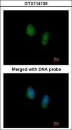 Anti-RAN antibody used in Immunocytochemistry/ Immunofluorescence (ICC/IF). GTX114139