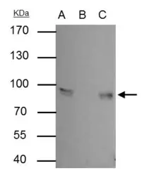 Anti-gamma Catenin antibody [C2C3], C-term used in Immunoprecipitation (IP). GTX114156