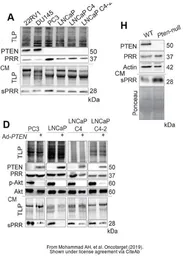 Anti-Renin Receptor antibody [N3C3] used in Western Blot (WB). GTX114169