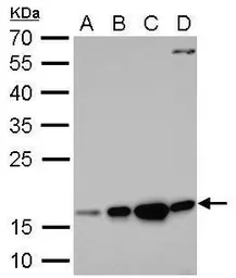 Anti-Destrin antibody used in Western Blot (WB). GTX114170