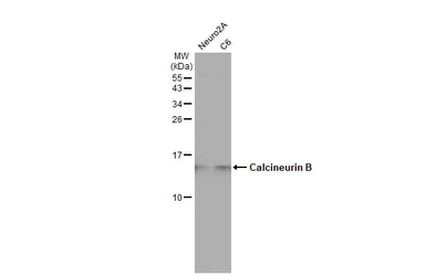 Anti-Calcineurin B antibody used in Western Blot (WB). GTX114181