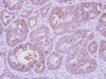 Anti-Calcineurin B antibody used in IHC (Paraffin sections) (IHC-P). GTX114181
