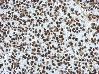 Anti-SFPQ antibody [N2C1], Internal used in IHC (Paraffin sections) (IHC-P). GTX114209
