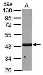 Anti-ACADSB antibody used in Western Blot (WB). GTX114231
