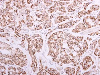 Anti-ACADVL antibody [N1C1] used in IHC (Paraffin sections) (IHC-P). GTX114232