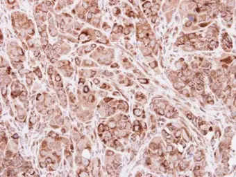 Anti-ACADVL antibody [N1C1] used in IHC (Paraffin sections) (IHC-P). GTX114232