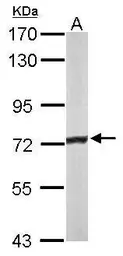 Anti-ACADVL antibody [N1C1] used in Western Blot (WB). GTX114232