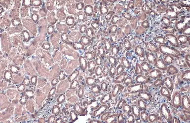 Anti-ACADVL antibody [N1C1] used in IHC (Paraffin sections) (IHC-P). GTX114232