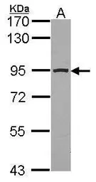 Anti-Aconitase 2 antibody [N1N3] used in Western Blot (WB). GTX114233