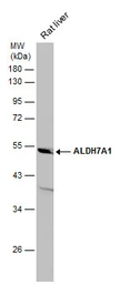 Anti-ALDH7A1 antibody [C1C3] used in Western Blot (WB). GTX114274