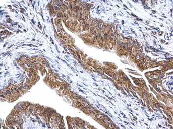Anti-ATP synthase gamma antibody used in IHC (Paraffin sections) (IHC-P). GTX114275