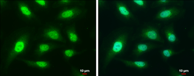 Anti-CAPG antibody [N3C3] used in Immunocytochemistry/ Immunofluorescence (ICC/IF). GTX114301