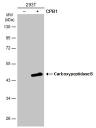 Anti-Carboxypeptidase B antibody [N3C3] used in Western Blot (WB). GTX114334
