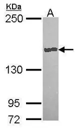 Anti-Carboxypeptidase D antibody [N2N3] used in Western Blot (WB). GTX114335