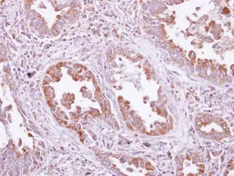 Anti-DARS antibody used in IHC (Paraffin sections) (IHC-P). GTX114356