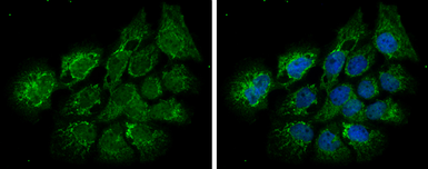 Anti-ECHS1 antibody [N1C2] used in Immunocytochemistry/ Immunofluorescence (ICC/IF). GTX114376