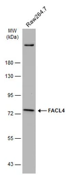 Anti-FACL4 antibody [N1N3] used in Western Blot (WB). GTX114399
