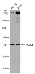 Anti-FACL4 antibody [N1N3] used in Western Blot (WB). GTX114399