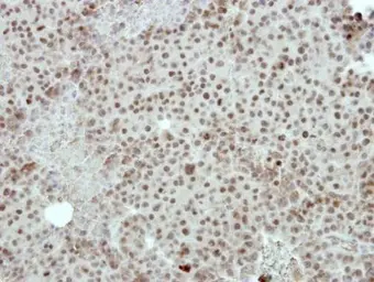 Anti-FOXI1 antibody [N2C3] used in IHC (Paraffin sections) (IHC-P). GTX114408