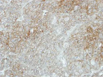 Anti-Flotillin 2 antibody [N1C1] used in IHC (Paraffin sections) (IHC-P). GTX114411