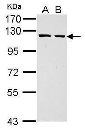 Anti-GART antibody [N1N2], N-term used in Western Blot (WB). GTX114422