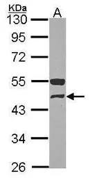 Anti-GCDH antibody used in Western Blot (WB). GTX114427