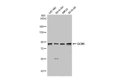 Anti-GCN5 antibody [C2C3], C-term used in Western Blot (WB). GTX114428