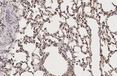 Anti-GCN5 antibody [C2C3], C-term used in IHC (Paraffin sections) (IHC-P). GTX114428