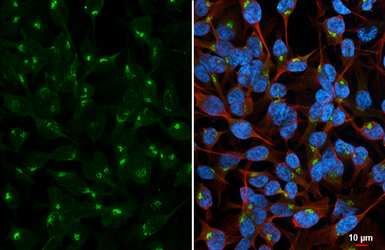 Anti-Golgin 97 antibody [C2C3], C-term used in Immunocytochemistry/ Immunofluorescence (ICC/IF). GTX114445