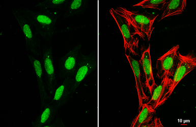 Anti-Histone H1.0 antibody used in Immunocytochemistry/ Immunofluorescence (ICC/IF). GTX114462