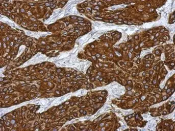 Anti-Cytokeratin 15 antibody used in IHC (Paraffin sections) (IHC-P). GTX114517