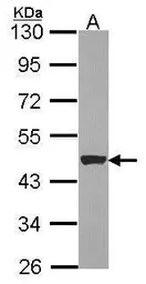 Anti-Cytokeratin 15 antibody used in Western Blot (WB). GTX114517