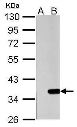 Anti-Galectin 4 antibody used in Western Blot (WB). GTX114527