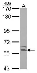 Anti-LMAN1 antibody [N1C1] used in Western Blot (WB). GTX114530