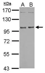 Anti-NBR1 antibody used in Western Blot (WB). GTX114539
