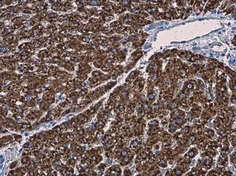 Anti-MGST1 antibody used in IHC (Paraffin sections) (IHC-P). GTX114551
