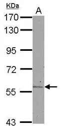 Anti-ALDH6A1 antibody used in Western Blot (WB). GTX114553