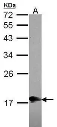 Anti-MOCS2 antibody [N1C3] used in Western Blot (WB). GTX114554