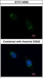 Anti-Nucleobindin 1 antibody [N3C3] used in Immunocytochemistry/ Immunofluorescence (ICC/IF). GTX114593